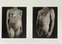 Chuck Close – Untitled ((Doctors of the World), 2001 – Impression numérique sur papier